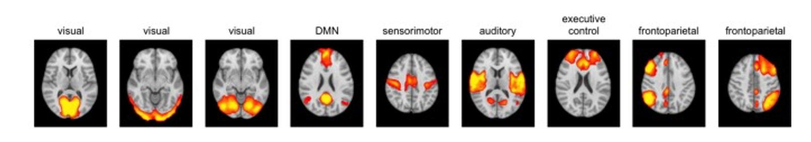Cognitive Brain Dynamics Lab Publications